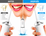 Irrigador bucal recargable Pulse Dental Cleaning